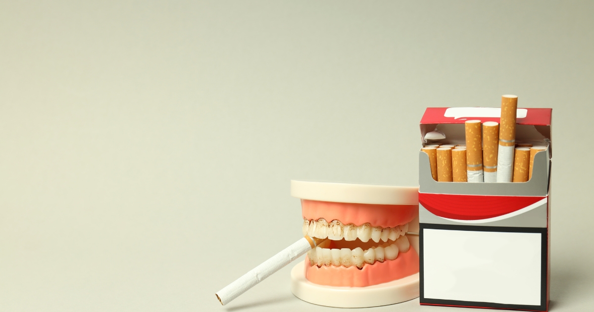 Teeth Whitening For Smokers - Everything You Need To Know - Lotus Dental and Aesthetics Clinic
