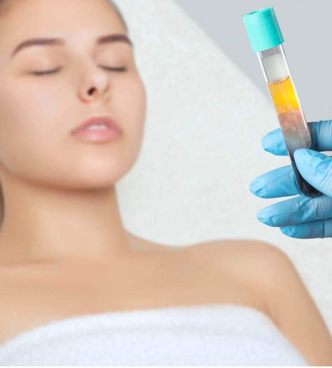 PRP Therapy in Golders Green, London