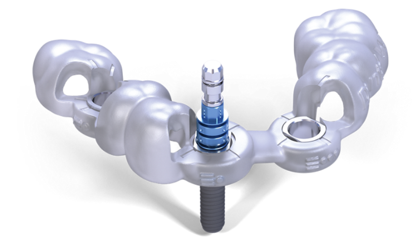 Fully Guided Implants