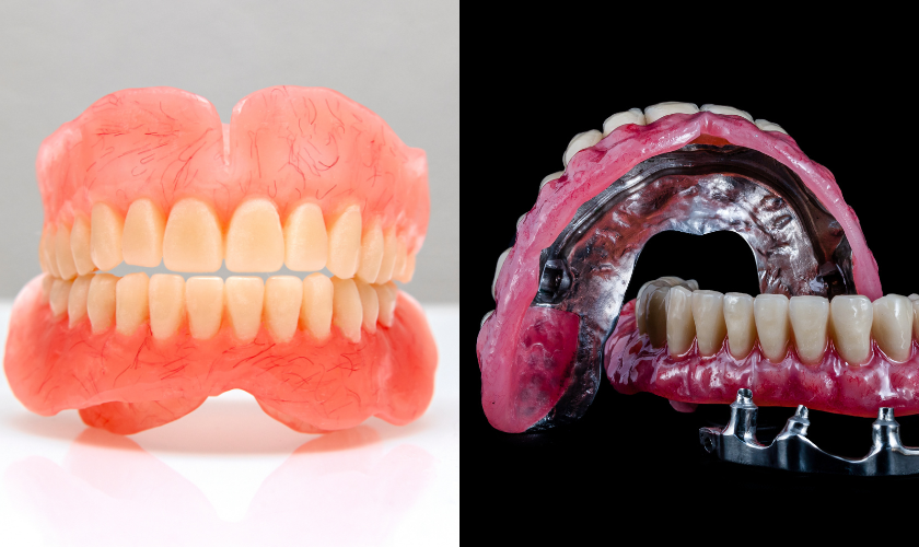 Snap-in Dentures vs Traditional Dentures