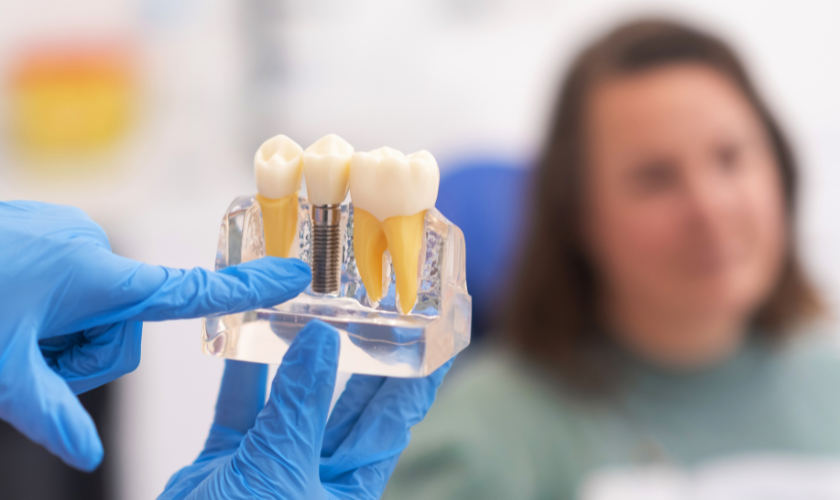Dental Implants