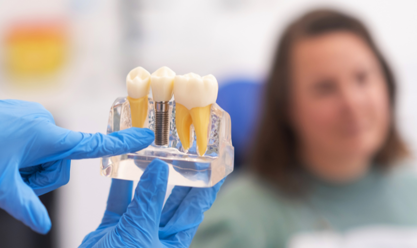 Candidate for Dental Implants