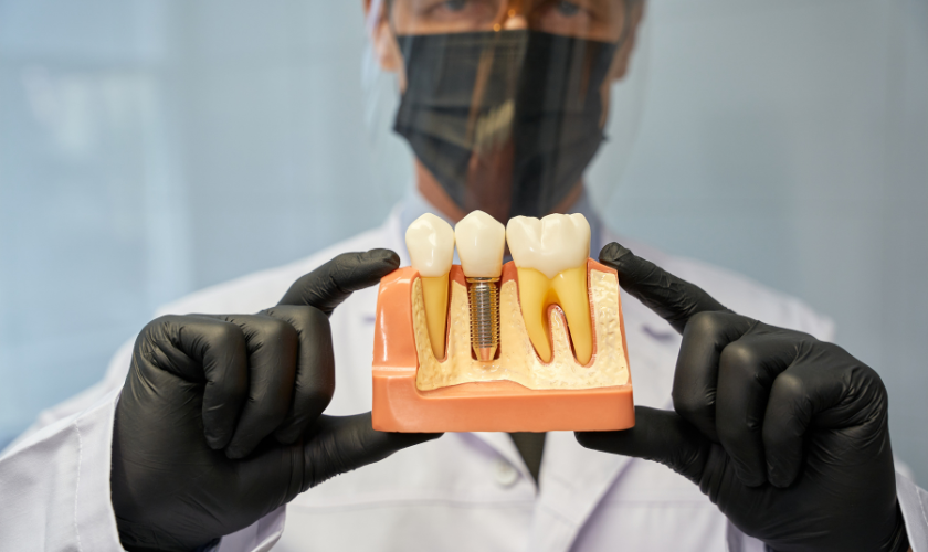 Dental Implants