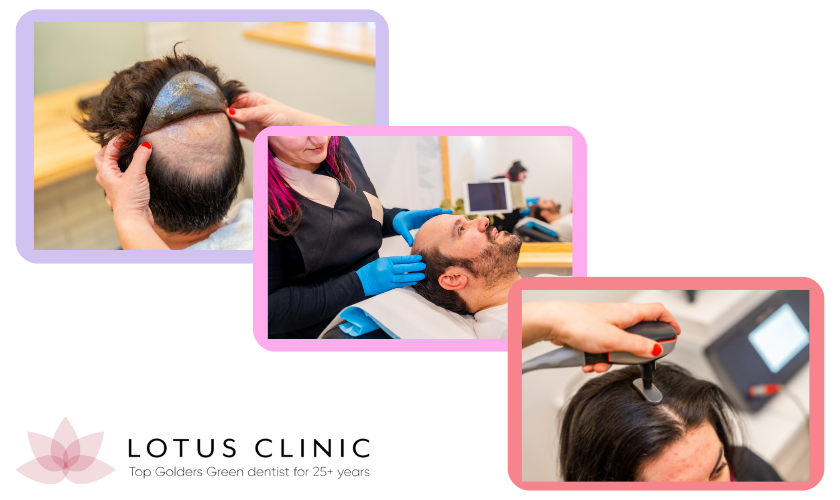 Traditional Hair Loss Treatments