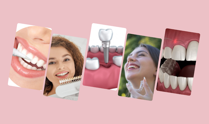 popular smile makeover procedures