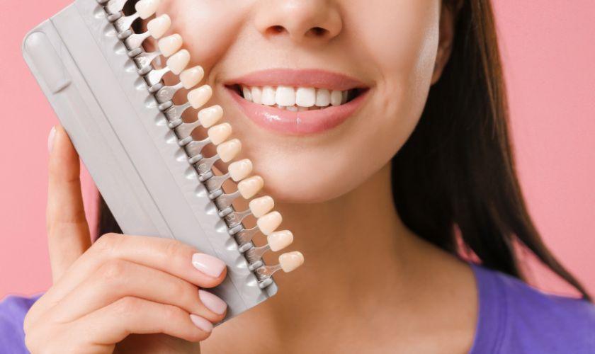 Benefits of Veneers for Crooked Teeth