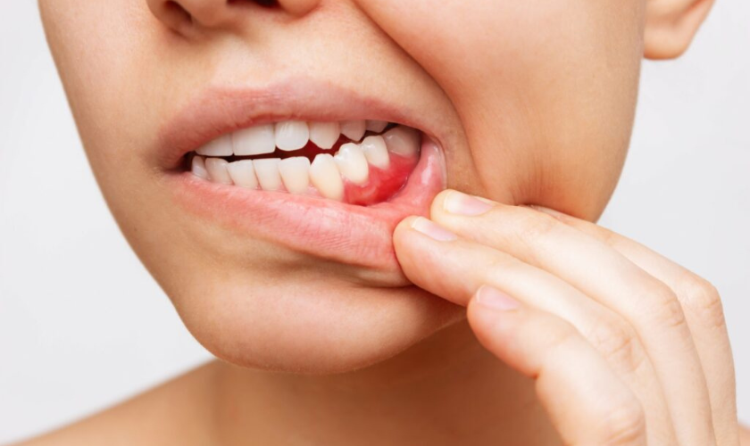 Early Warning Signs of Oral Issues