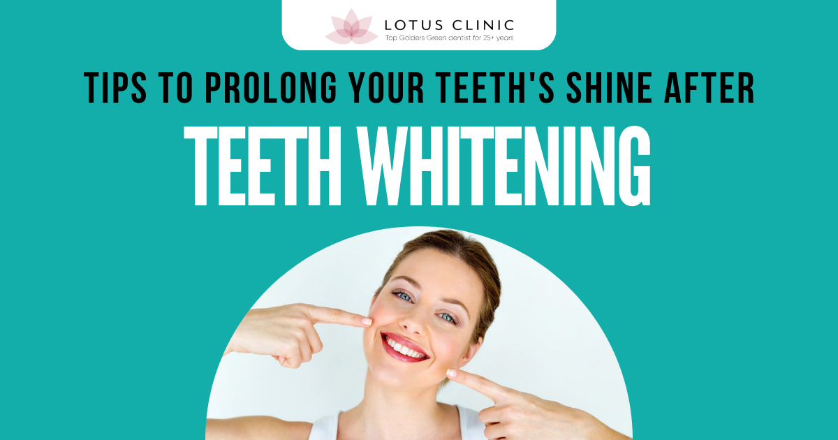 Tips to Prolong Your Teeth Shine After Whitening