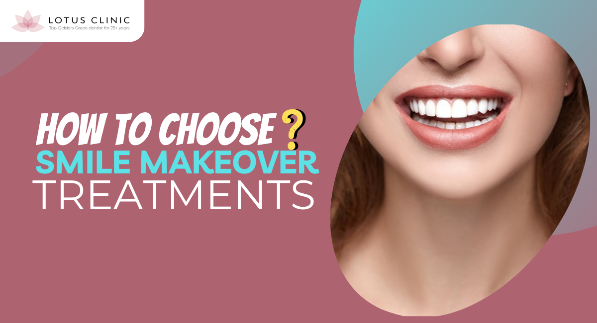 how to choose the best smile makeover treatments based on your unique needs