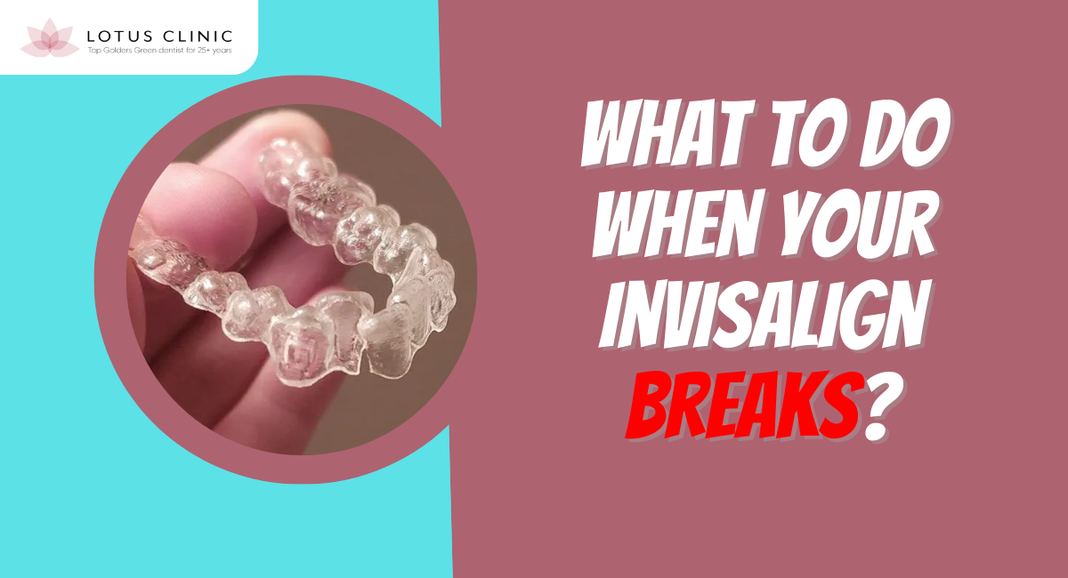 what to do when your invisalign breaks